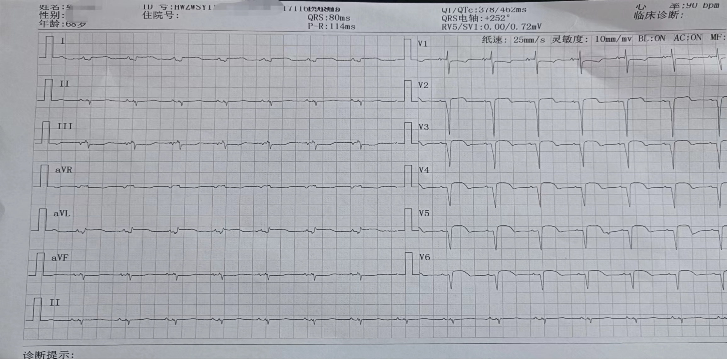 抢救心肌，抢救生命，分秒必争