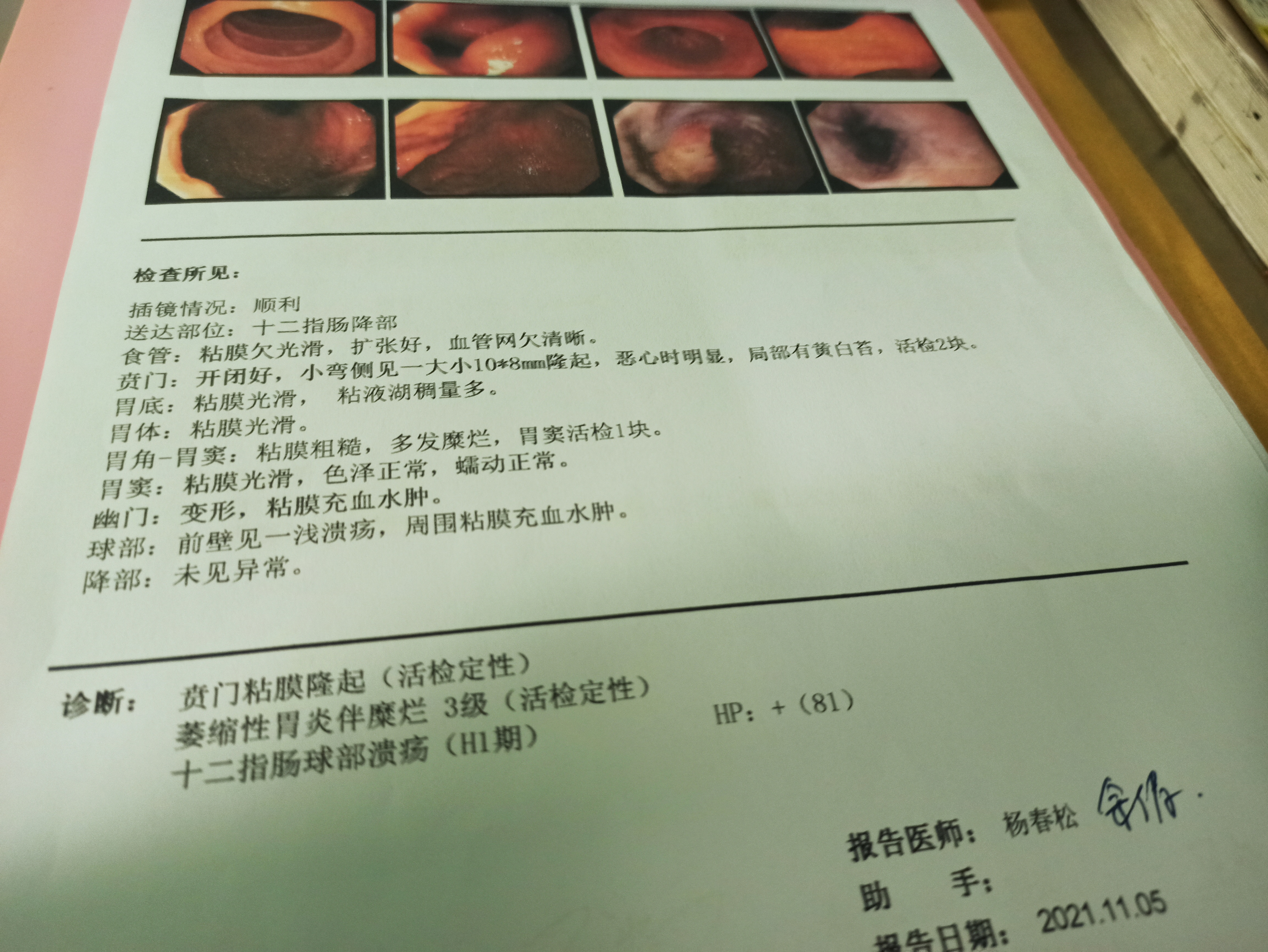 胃镜检查单.jpg