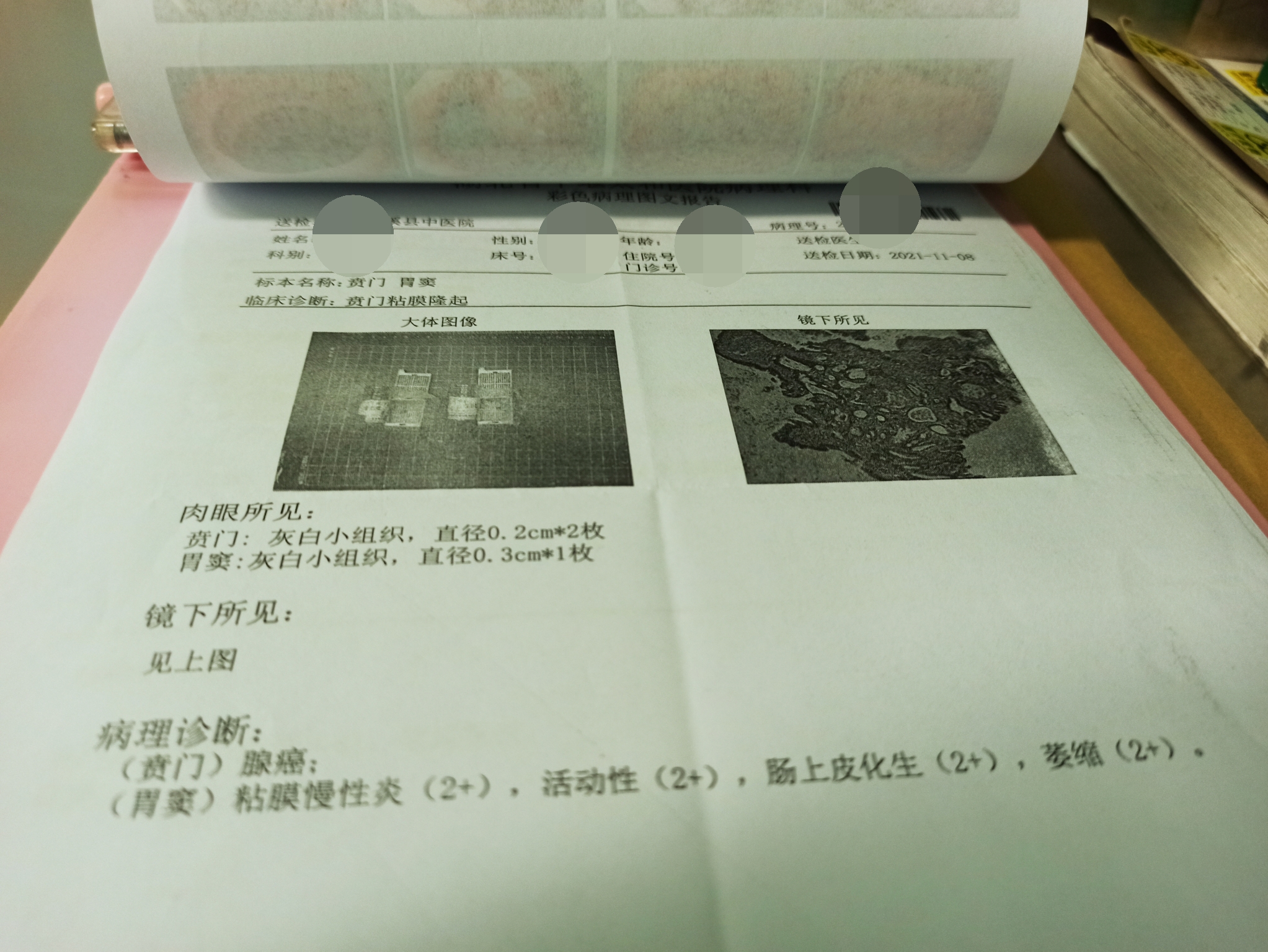 病历报告单.jpg